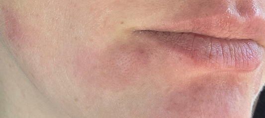 Why Your Skincare Suddenly Stopped Working